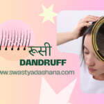 रूसी (Dandruff)